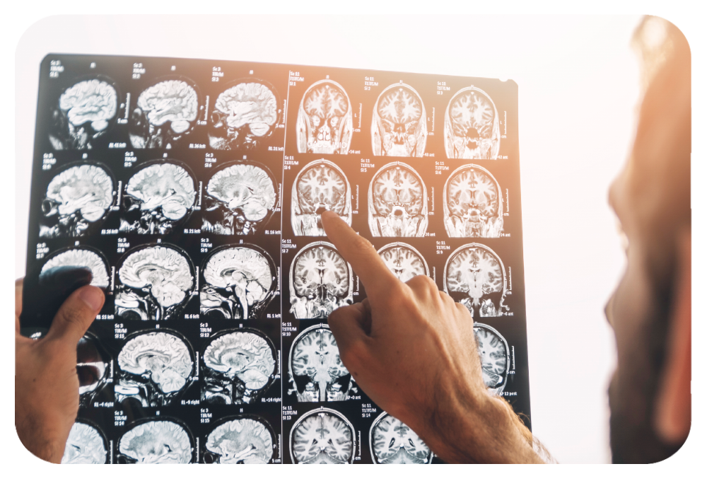 neurologische-klachten neurologische-klachten